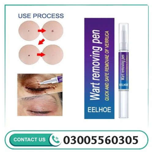 Wart Removing Pen Price In Pakistan